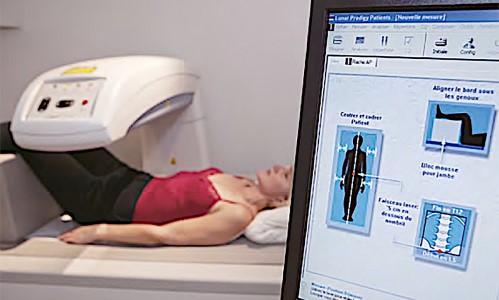 雙能量X光吸收測量儀是現今最常用診斷骨質疏鬆的檢查方法。